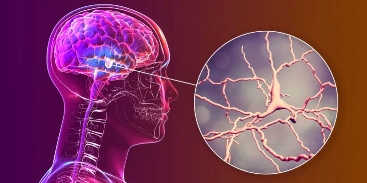 Parkinson tedavisinde önemli gelişme: Kök hücre tedavisi başarılı sonuç verdi