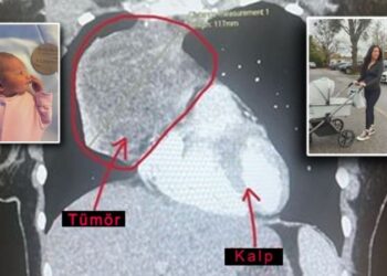Doğmamış bebeği hayatını kurtardı: ‘Ultrasonda öğrendi…’