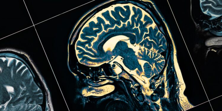 Alzheimer için umut veren çalışma: Nöronlar “çöp”ten geri kazanıldı