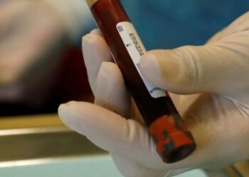 Bazı kanser türlerini belirtiler görülmeden tespit eden kan testi geliştirildi