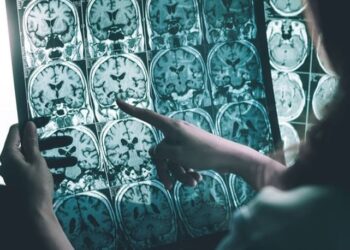 Üniversite öğrencisi Alzheimer’ın peşinde