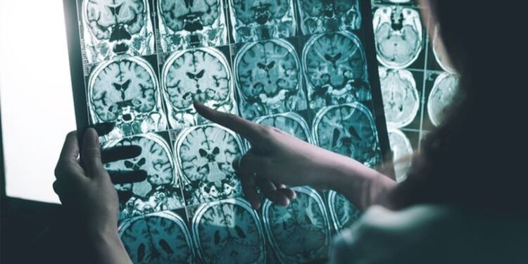 Üniversite öğrencisi Alzheimer’ın peşinde