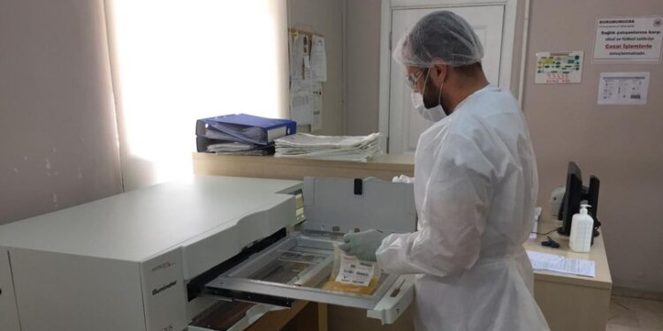 İmmün plazma tedavisinde yeni yöntem