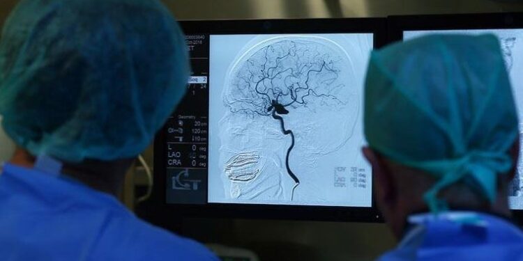 Konuşamayan felçli hastanın aklından geçenler bilgisayar algoritmasıyla okunup ekranda cümlelere döküldü