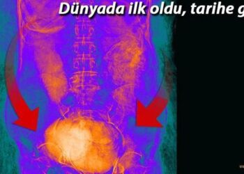 Dünyada bir ilk! Hamile bir kadına ait antik Mısır mumyası bulundu