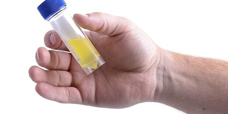 İdrar süzgeci ile tüm Dünya’ya içme suyu sağlanabilir