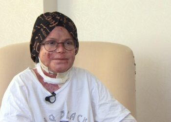 Kelebek hastası Büşra yaşadıklarını kitap haline getirdi