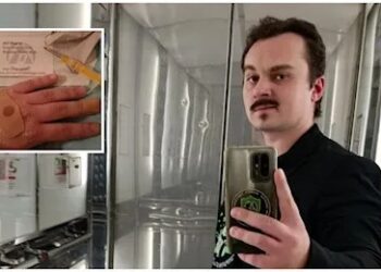 5 parmağında 5 mikroçip: Temassız adam cüzdan taşımıyor